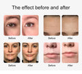 New 10 In 1 Aqua Peeling Lift Skin Bubble Moisturizer Oxygen Machine Skin Care Cleansing Facial Equipment