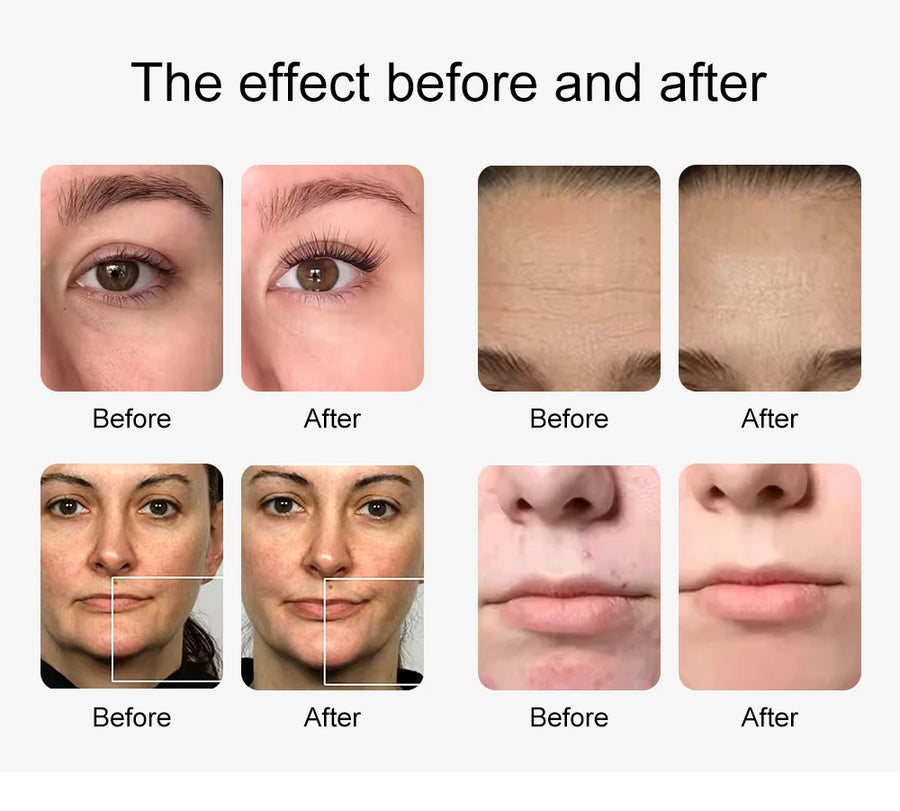 New 10 In 1 Aqua Peeling Lift Skin Bubble Moisturizer Oxygen Machine Skin Care Cleansing Facial Equipment